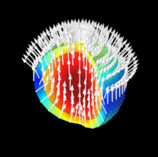 In silico assessment of electrophysiological neuronal recordings mediated by magnetoelectric nanoparticles