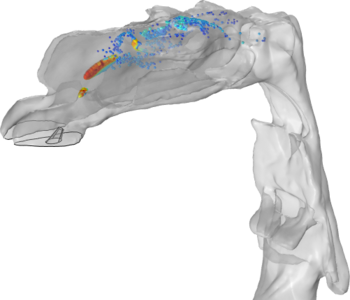 Spray Particle Deposition in Human Airways