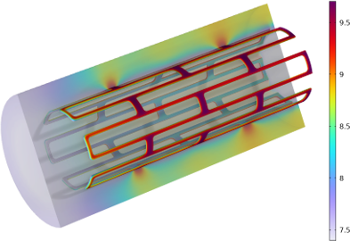 Biodegradation of a Magnesium Stent