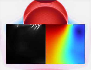 Shock Wave Lithotripsy