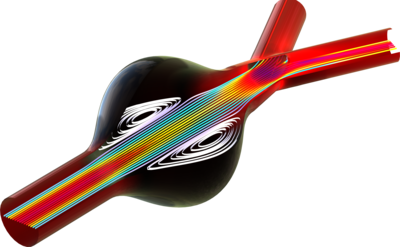 Blood Flow Through an Abdominal Aortic Aneurysm