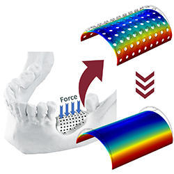 Developing 2D and 3D micropolar FEM models for porous GBR meshes in ...