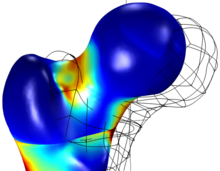 Determination of Mechanic Resistance of Osseous Element Through Finite ...