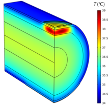 A Model of Noninvasive Radiofrequency Tissue Heating