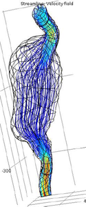 Hemodynamic Simulations of Implanted Multilayer Flow Modulator