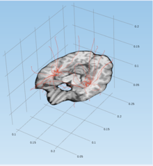 Comparing Isotropic and Anisotropic Brain Conductivity Modeling: Planning ...