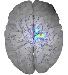 A Comparison Between an A-V and V Formulation in Transcranial Magnetic ...