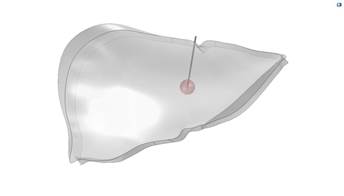 Pre-clinical Modelling and Simulation of Hepatic Radiofrequency Ablation