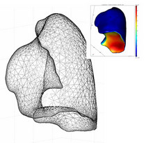 Modeling of Respiratory Lung Motion as a Contact Problem of Elasticity ...