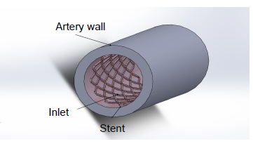 An Examination of Wall Shear Stresses in Curved Arterial Vessels Using ...