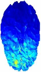 Image Based-Mesh Generation for Realistic Simulation of theTranscranial ...