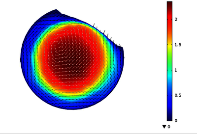 内壁含有螺旋褶皱血管促旋动流机制仿真分析