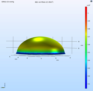 THREE-DIMENSIONAL GRAPHENE AS SENSING ELEMENT FOR INTRAOCULAR PRESSURE ...