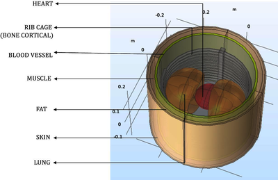 COMSOL Multiphysics® Simulation of Electrical Bioimpedance Impedance in a ...