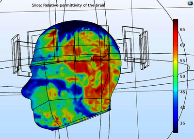 Low-Cost and Portable Microwave Medical Imaging for Stroke Detection