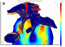 A Biological Gear in the Human Middle Ear