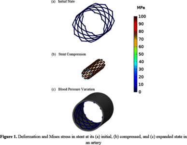Stress/Strain Analysis of a Nitinol Self-Expanding Stent