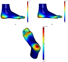 From CT Scan to Plantar Pressure Map Distribution of a 3D Anatomic Human ...