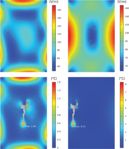 Radiofrequency-Induced Heating of Medical Devices in MRI Systems